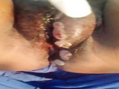 Hincada como una puntilla